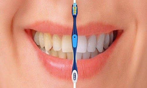 Set 8 bàn chải đánh răng Oral-B Cross Action Advanced có tốt không-3